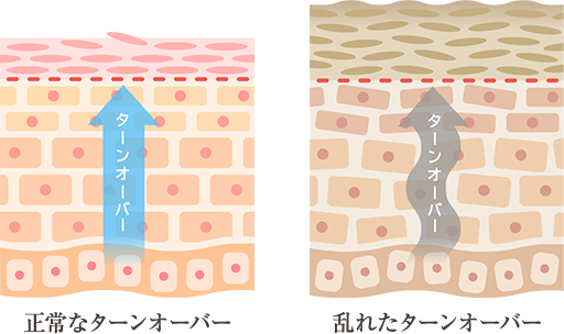 大人の肌悩みはターンオーバーが乱れていることが原因なんです