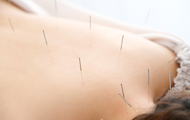 細やかなカウンセリングと説明を行い、ご納得いただいてから施術に入ります